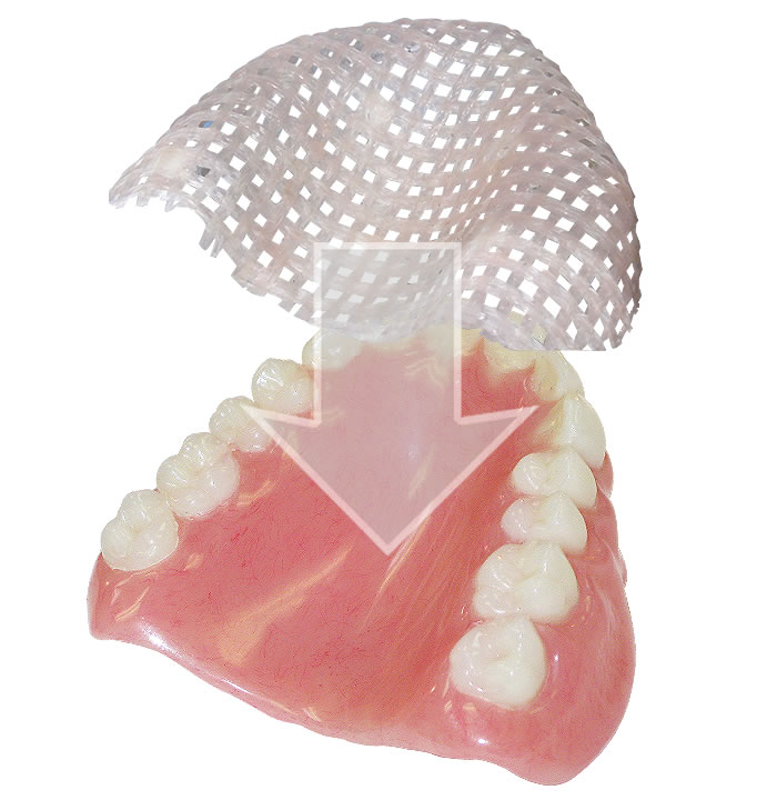 fiber force denture